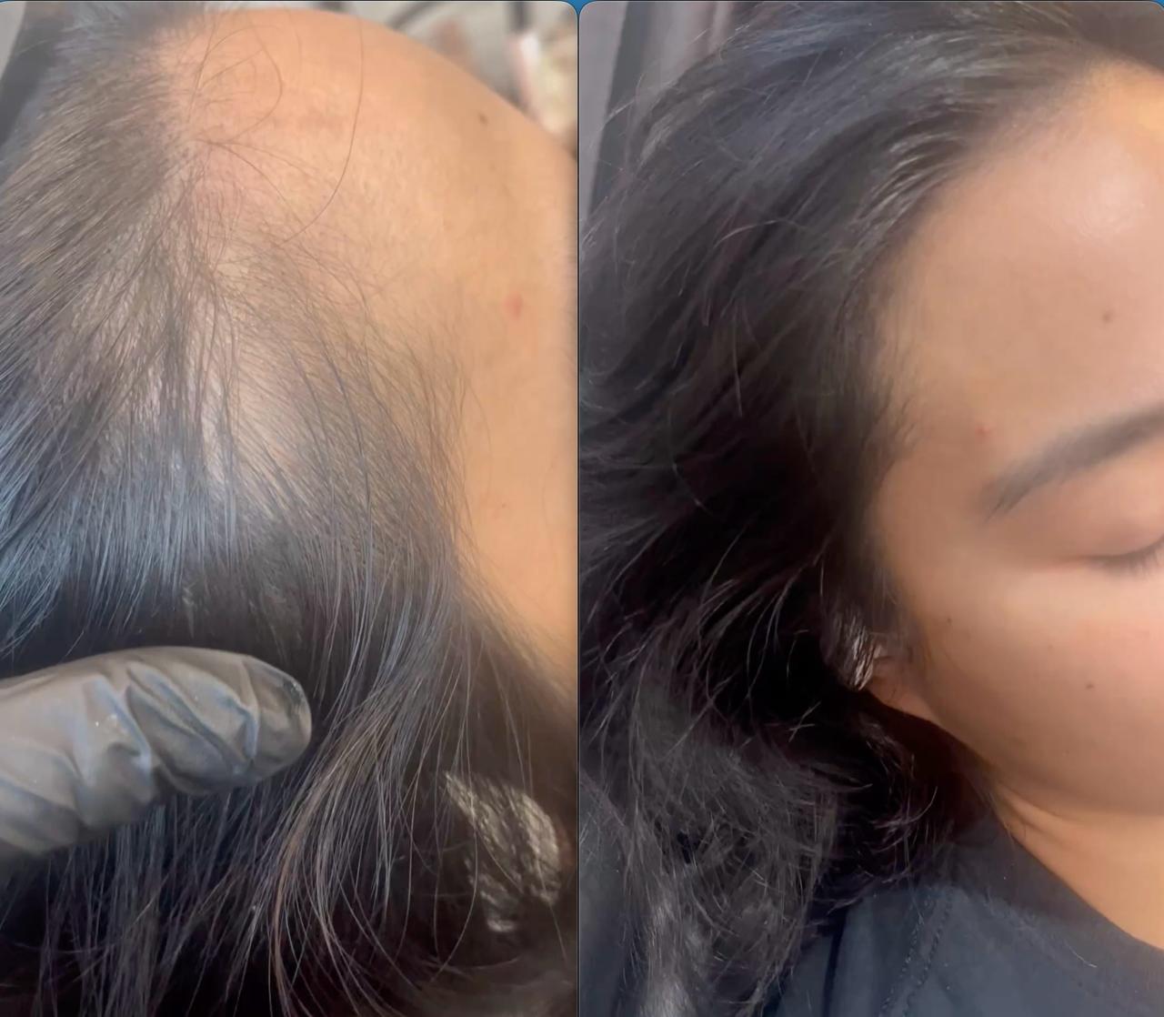 Client result, before and after